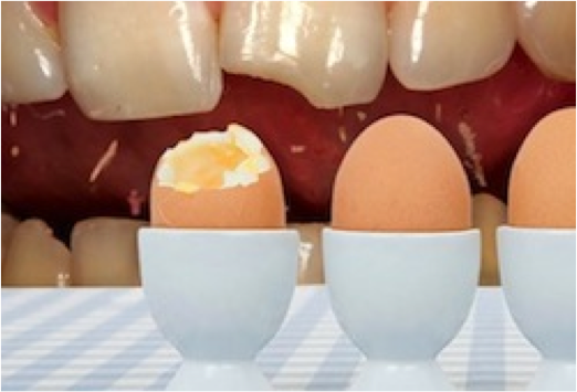 eggs in egg cups with open mouth in background