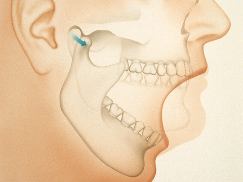 illustration of jaw and open mouth