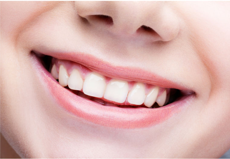 Cosmetic Dentistry, giving you a perfect smile