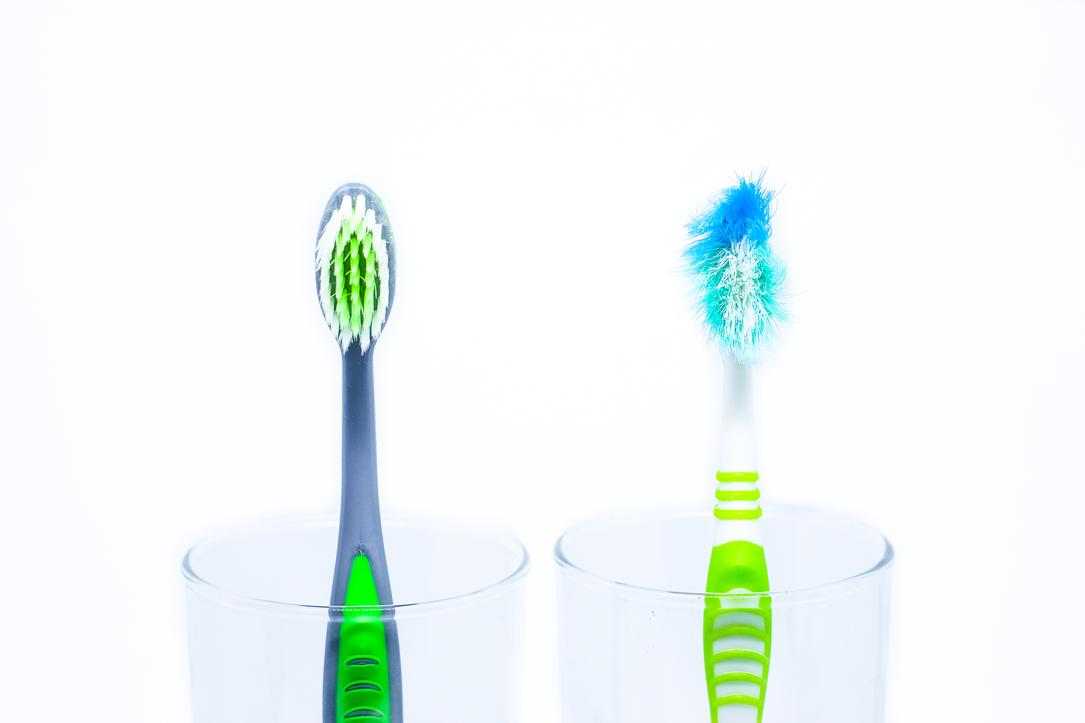 Photograph of two green and blue tooth brushes. One is worn out and the other is new and in good condition.