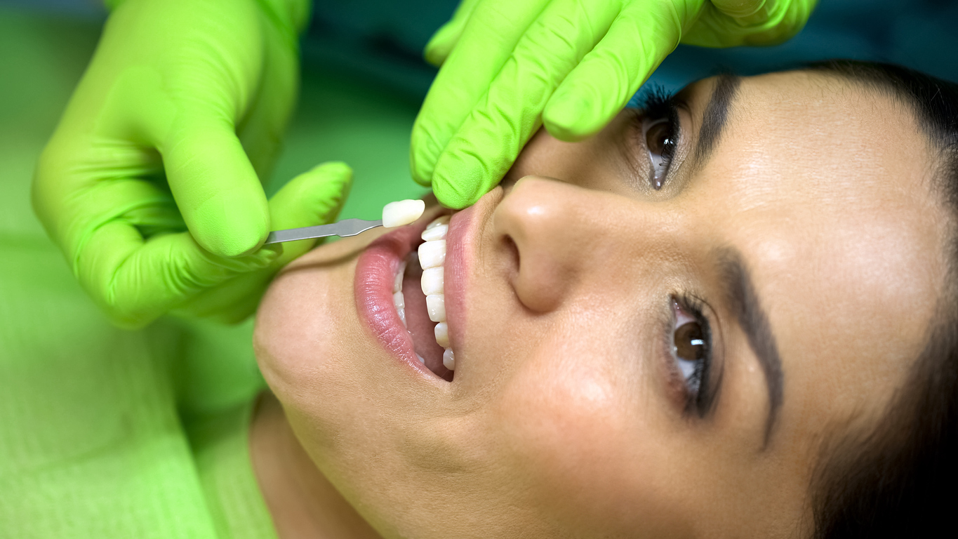 A dentist fits a patient with a new porcelain veneer.