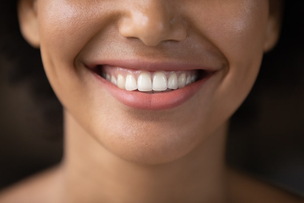 Teeth whitening Treatment KoR